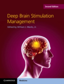 Image for Deep Brain Stimulation Management