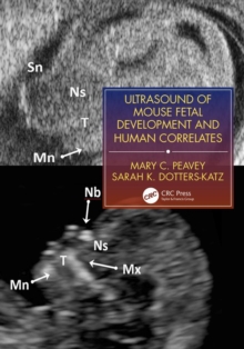 Image for Ultrasound of mouse fetal development and human correlates