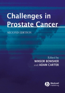 Image for Challenges in Prostate Cancer
