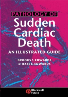 Image for Pathology of sudden cardiac death