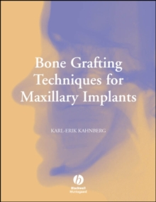 Bone Grafting Techniques for Maxillary Implants