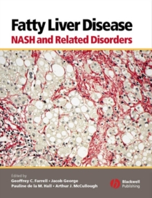 Image for Fatty liver disease: NASH and related disorders