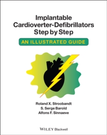 Image for Implantable cardioverter-defibrillators step by step  : an illustrated guide