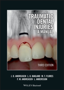 Image for Traumatic dental injuries  : a manual