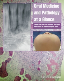 Image for Oral medicine and pathology at a glance
