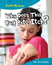 Image for Why does this Bite Itch?