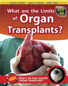 Image for What Are the Limits of Organ Transplantation?