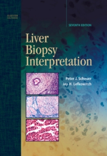Image for Liver Biopsy Interpretation