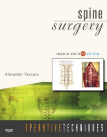 Image for Spine Surgery