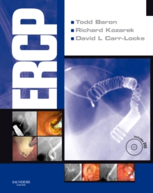 Image for ERCP