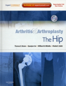 Image for Arthritis and Arthroplasty: The Hip