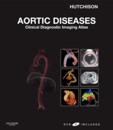 Image for Aortic Diseases