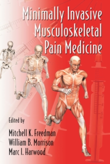 Image for Minimally invasive musculoskeletal pain medicine