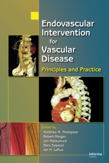 Image for Endovascular intervention for vascular disease: principles and practice