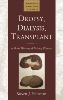 Image for Dropsy, dialysis, transplant: a short history of failing kidneys