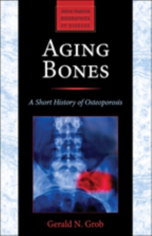 Aging Bones