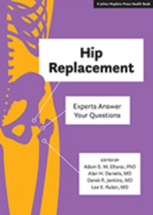 Image for Hip Replacement : Experts Answer Your Questions
