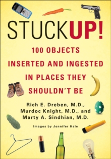 Image for Stuck Up!: 100 Objects Inserted and Ingested in Places They Shouldn't Be