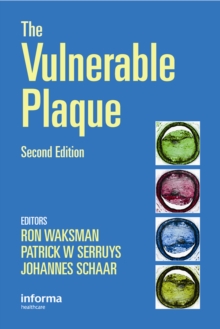 Image for The vulnerable plaque.