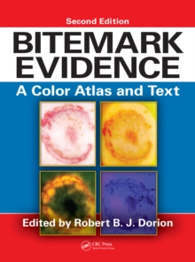 Image for Bitemark evidence: a color atlas and text