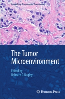 Image for The tumor microenvironment