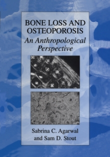 Image for Bone Loss and Osteoporosis: An Anthropological Perspective