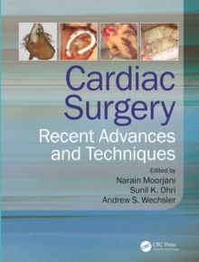Image for Cardiac surgery: recent advances and techniques