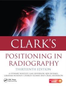 Image for Clark's positioning in radiography.