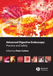 Image for Advanced digestive endoscopy: practice and safety