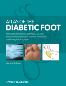 Image for Atlas of the Diabetic Foot