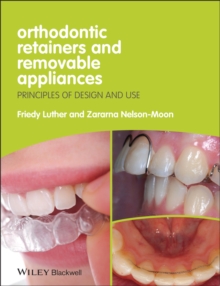 Image for Orthodontic Retainers and Removable Appliances