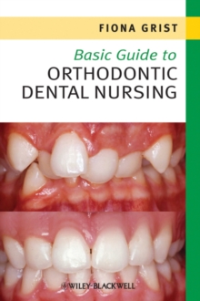 Image for Basic guide to orthodontic dental nursing