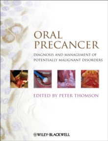 Image for Oral precancer  : diagnosis and management of potentially malignant disorders