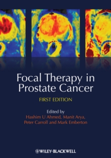 Image for Focal Therapy in Prostate Cancer