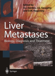 Image for Liver Metastases: Biology, Diagnosis and Treatment