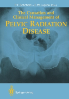 Image for The Causation and Clinical Management of Pelvic Radiation Disease