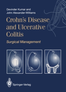 Image for Crohn's disease and ulcerative colitis