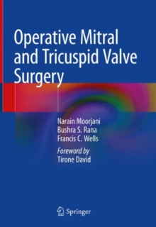 Image for Operative Mitral and Tricuspid Valve Surgery