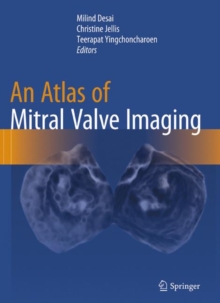 Image for An Atlas of Mitral Valve Imaging