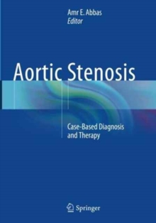 Image for Aortic Stenosis