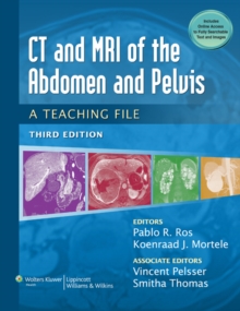 Image for CT & MRI of the Abdomen and Pelvis