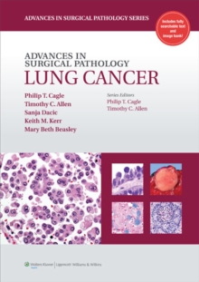 Image for Advances in surgical pathology.: (Lung cancer)