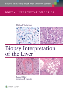 Image for Biopsy interpretation of the liver