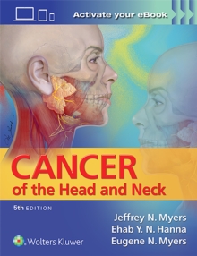 Image for Cancer of the Head and Neck