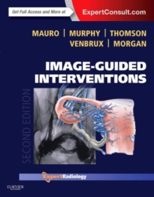 Image for Image-Guided Interventions