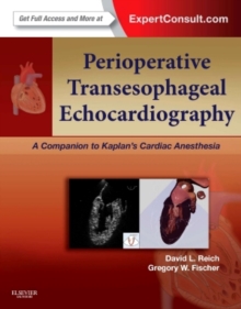 Image for Perioperative transesophageal echocardiography  : a companion to Kaplan's cardiac anesthesia