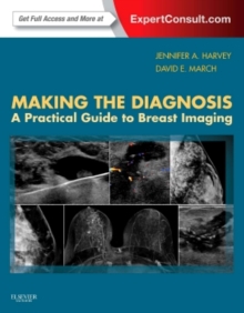 Image for Making the diagnosis  : a practical guide to breast imaging