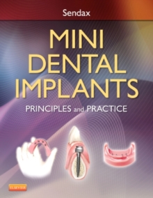 Image for Mini Dental Implants