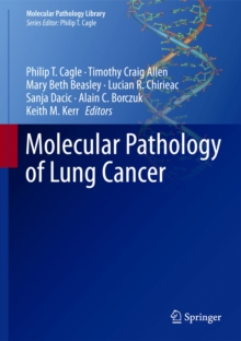Image for Molecular pathology of lung cancer