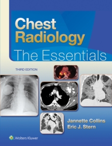 Image for Chest radiology: the essentials